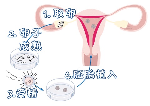 时差成像